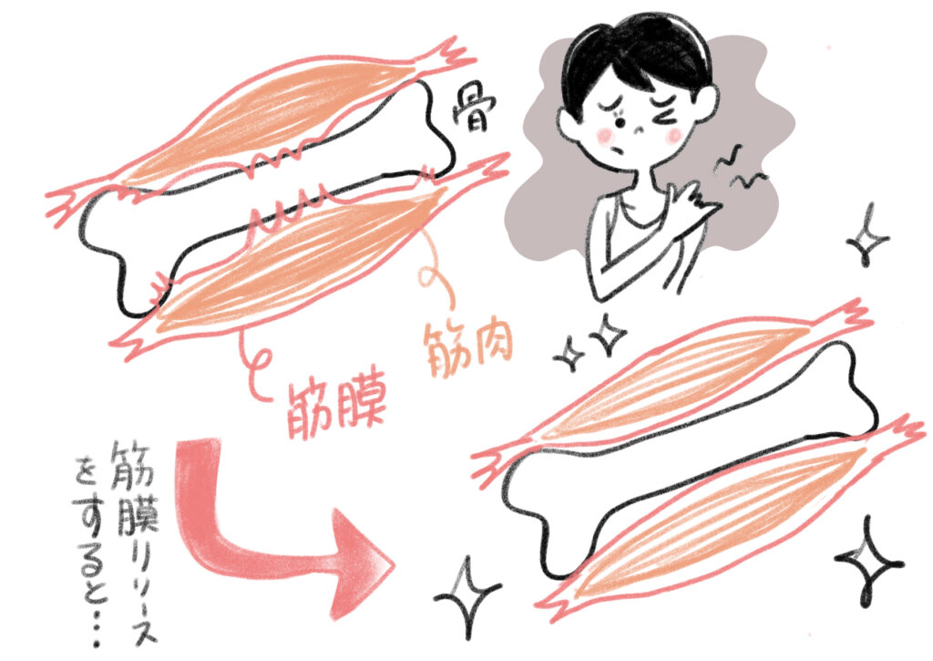筋膜リリースのイメージ図